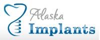 Anchorage Dental Implants | Affordable Dental Implants Anchorage AK